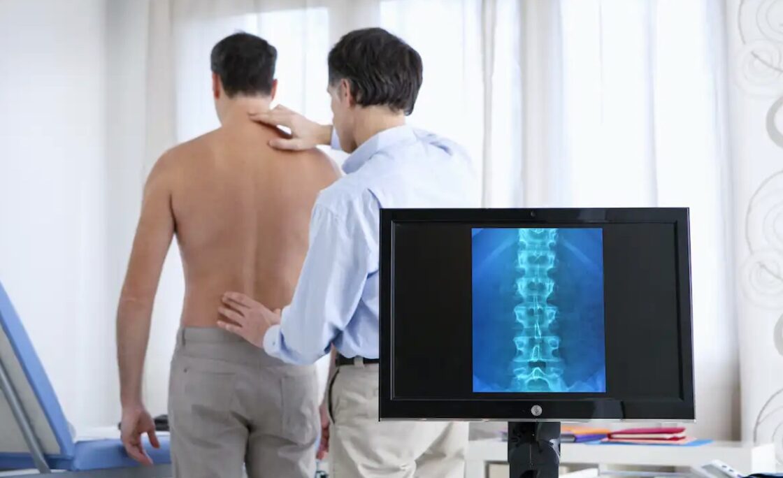 Cinco cosas que debería saber sobre el dolor de espalda